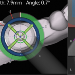 X-Guide Navigate