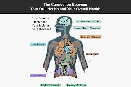 oral health
