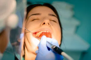 dentist checking for decay in a patients tooth pulp