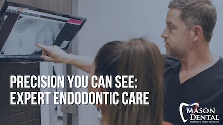 endodontics graphic