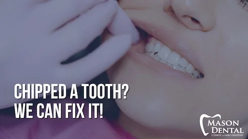 chipped a tooth