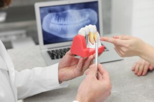 doctor showing a patient a model dental implant