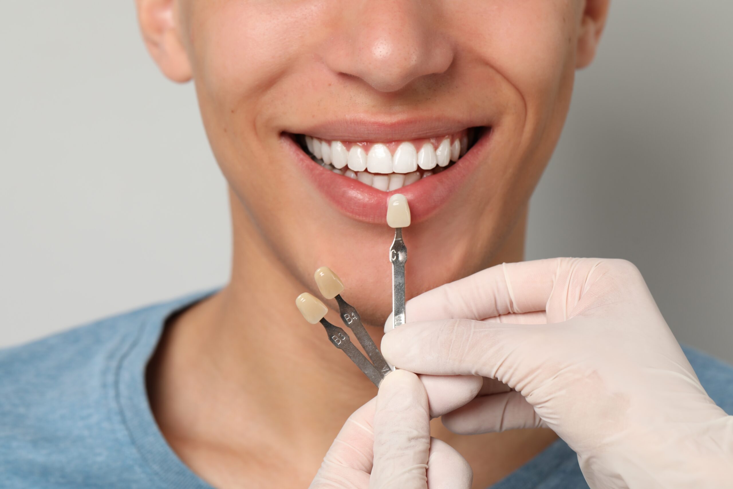 dentist checking the shade of a young man's tooth
